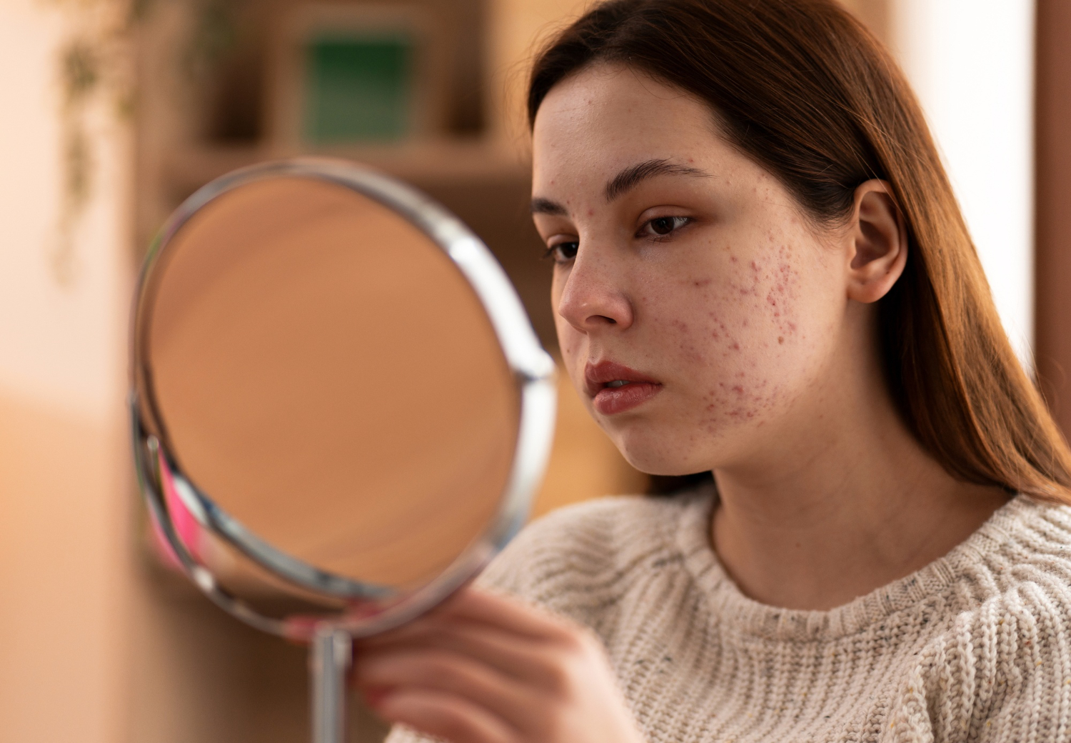 Acne and Skin Breakouts