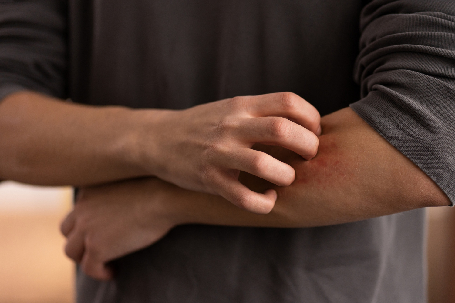 Persistent Itching and Skin Irritation