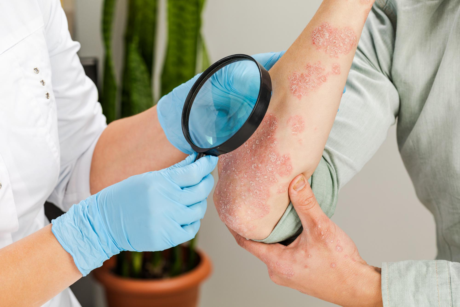Skin health